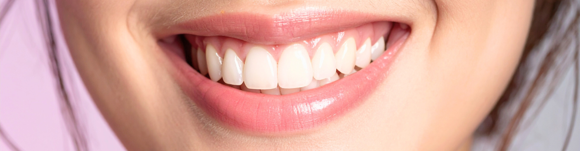 Close-up photo of woman's smile.